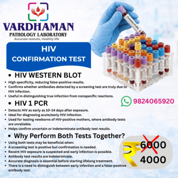 HIV Confirmation Test at Vardhaman Pathology Laboratory featuring HIV Western Blot and HIV PCR tests for accurate HIV diagnosis and early infection detection in Ahmedabad.